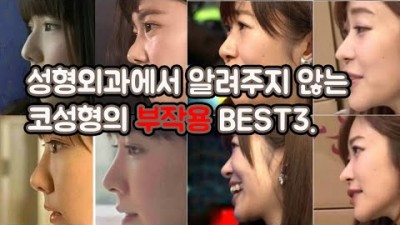 성형부작용 성형외과추천 코수술 수술부작용 콧볼축소 추천 및 소개