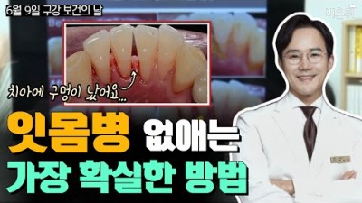 임플란트 잇몸병 양치습관 치과치료 잇몸치료 받아야 하는 이유 건강보험 혜택 방법