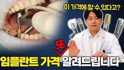 오스템 임플란트가격 임플란트비용 임플란트수명  임플란트종류 및 소개