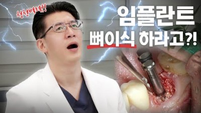 임플란트 뼈이식 임플란트 뼈이식 종류와 뼈이식 케이스 알아보기