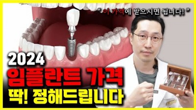 임플란트 가격차이 이유 합리적인 가격 총정리