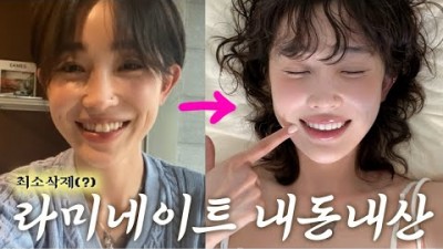 라미네이트 내돈내산 가짜치아 잇몸성형, 가격, 부작용, 장단점 꿀팁